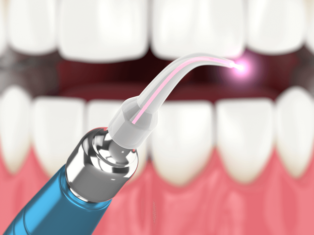 Upcoming Dental Technology  